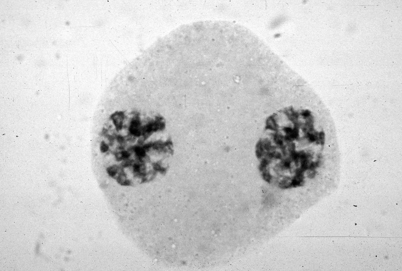 slides of meiosis in Paeonia, Paeonia californica, interphase