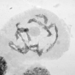 slides of meiosis in Paeonia, Paeonia californica, diakinesis, early